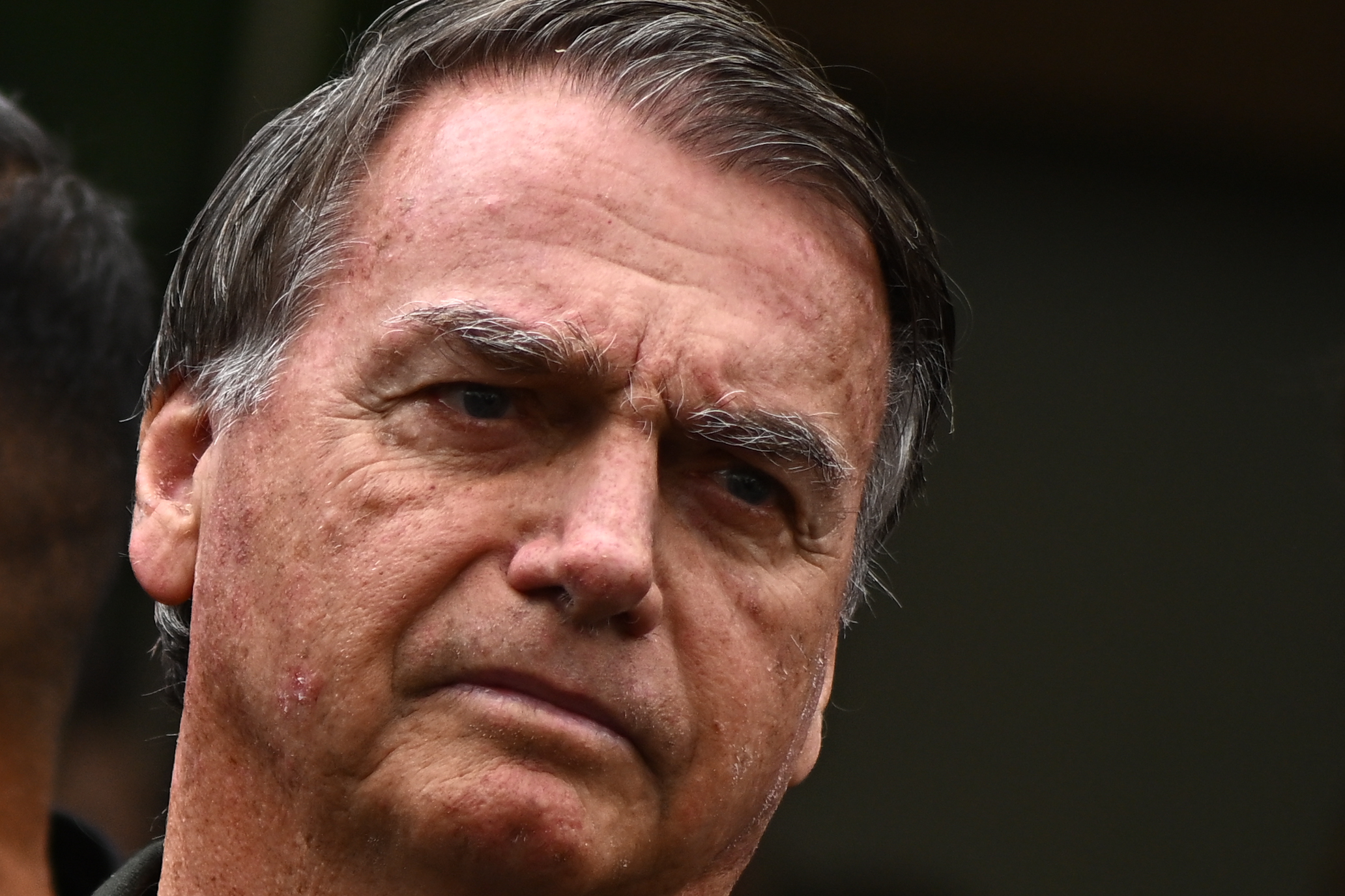 Bolsonaro vuelve al arresto domiciliario 7 horas después de pasar intervención quirúrgica
